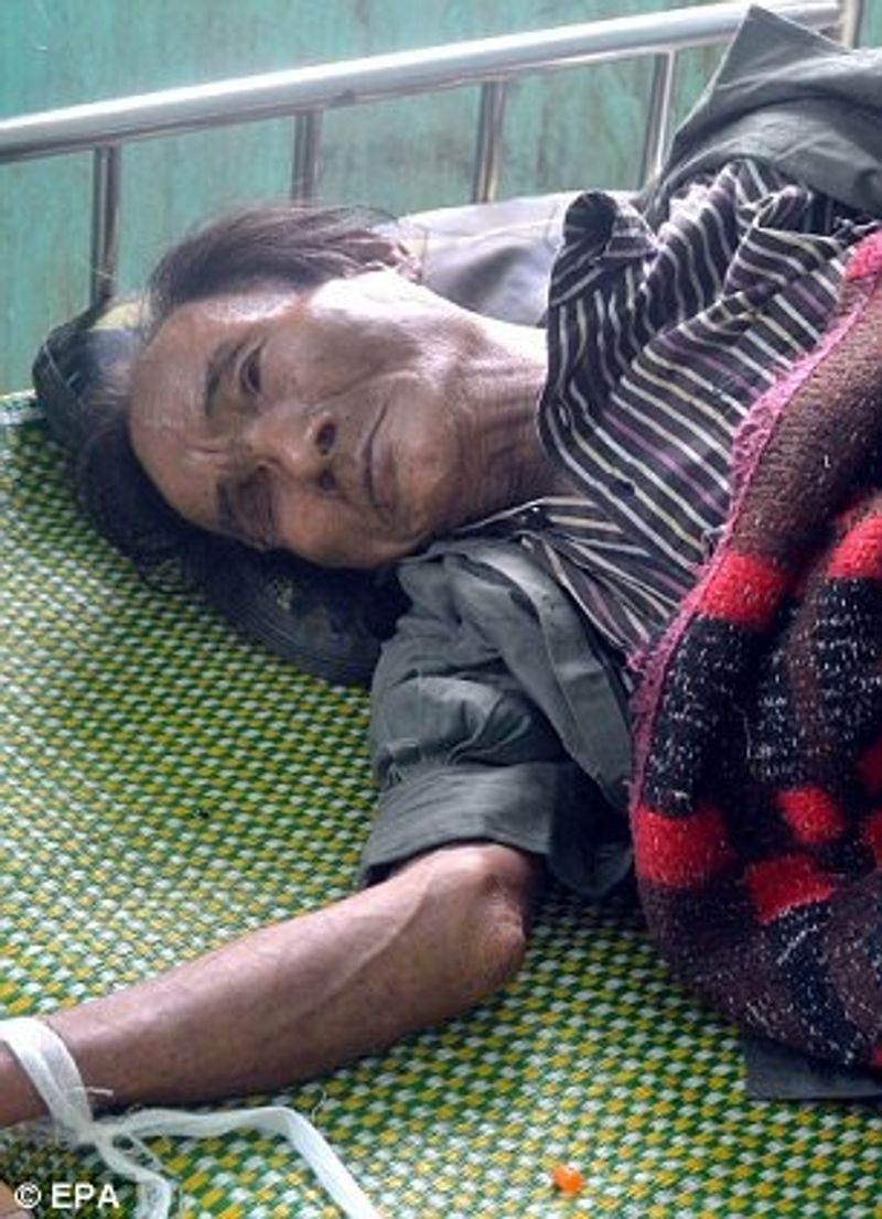 real life Tarzan 8 years after returning to the civilized world he died of cancer