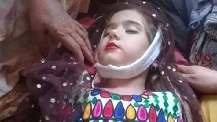 Fact Check of viral picture of Taliban punishing an innocent to death Fact Check of viral picture of Taliban punishing an innocent to death