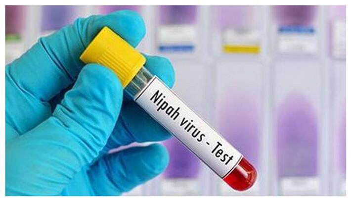 five yearold girl dies of fever in chengala test result says its not nipah five yearold girl dies of fever in chengala test result says its not nipah