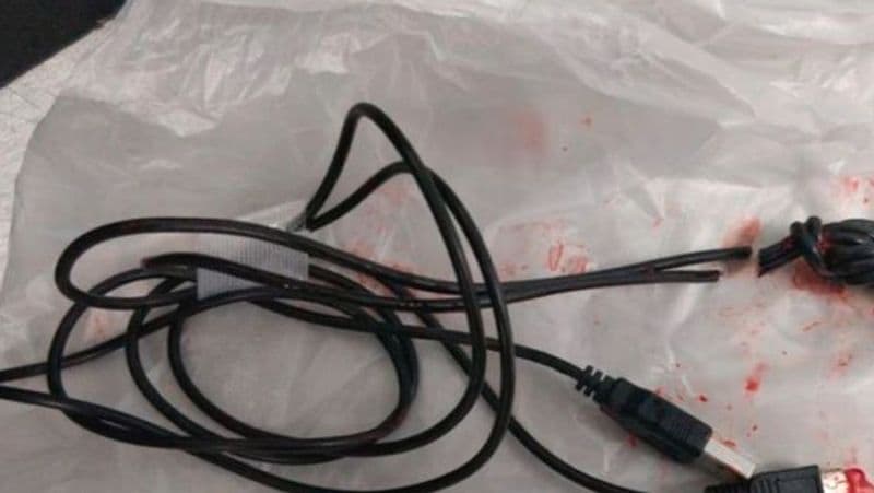 Weird news London 15-year-old boy inserted a USB cable inside his body to measure the length of his penis