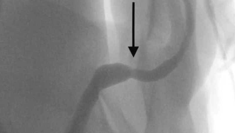 Weird news London 15-year-old boy inserted a USB cable inside his body to measure the length of his penis