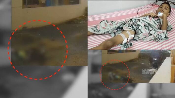 Six yera old child seriously injured in stray dog attack in Tirupur Six yera old child seriously injured in stray dog attack in Tirupur