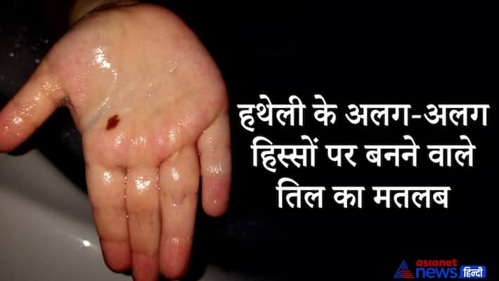 Palmistry mole on palm can tell about your luck and financial condition Palmistry mole on palm can tell about your luck and financial condition