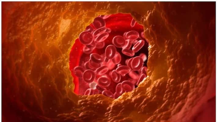 this fruit helps beat obesity and cholesterol this fruit helps beat obesity and cholesterol