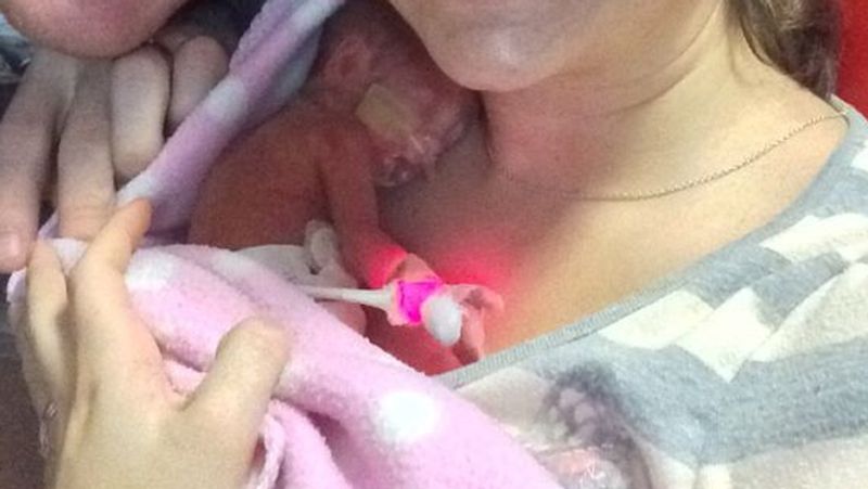America premature baby could wear her father wedding ring as a bracelet