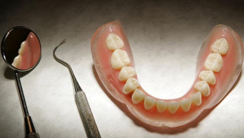 Know 5 things about teeth they already tell whether you have HIV or kidney disease