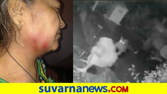 Mumbai Leopard attacks woman near Aarey Dairy fourth attack in recent days pod Mumbai Leopard attacks woman near Aarey Dairy fourth attack in recent days pod