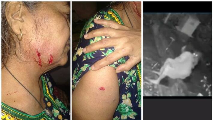 woman attacked by leopard in mumbai woman attacked by leopard in mumbai
