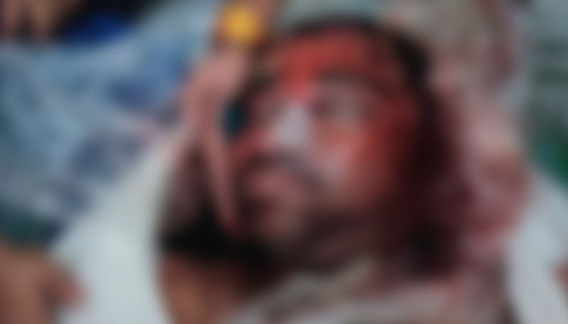 Manish Gupta murder case, wife shares his dead body photo, picture just before death also surfaces