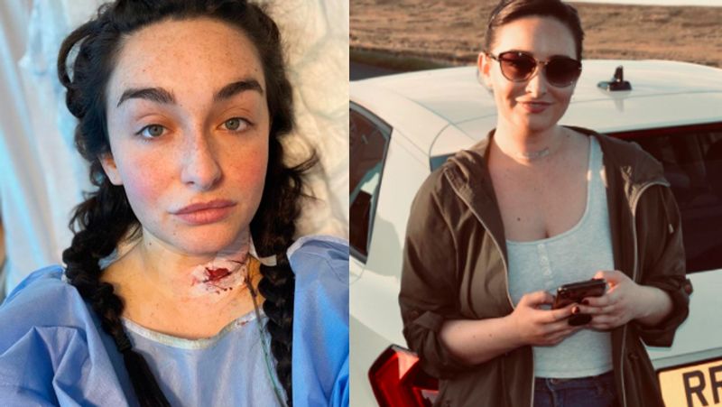 Lifestyle blogger Mia Mackin assuming pregnancy doctor checked two cancers were diagnosed