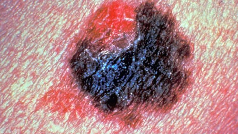 uk GenesisCare a specialist global cancer care provider studied breast cancer