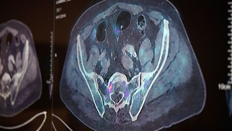 uk GenesisCare a specialist global cancer care provider studied breast cancer