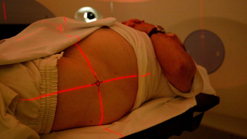 uk GenesisCare a specialist global cancer care provider studied breast cancer