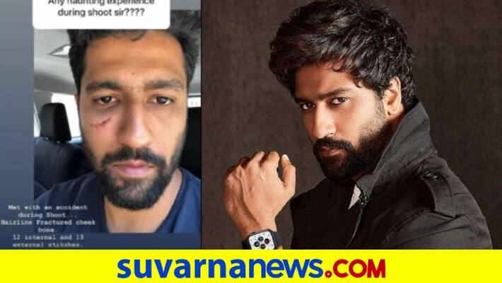 The Scar On Vicky Kaushals Face Actor Shares How He Got 25 Stitches dpl The Scar On Vicky Kaushals Face Actor Shares How He Got 25 Stitches dpl