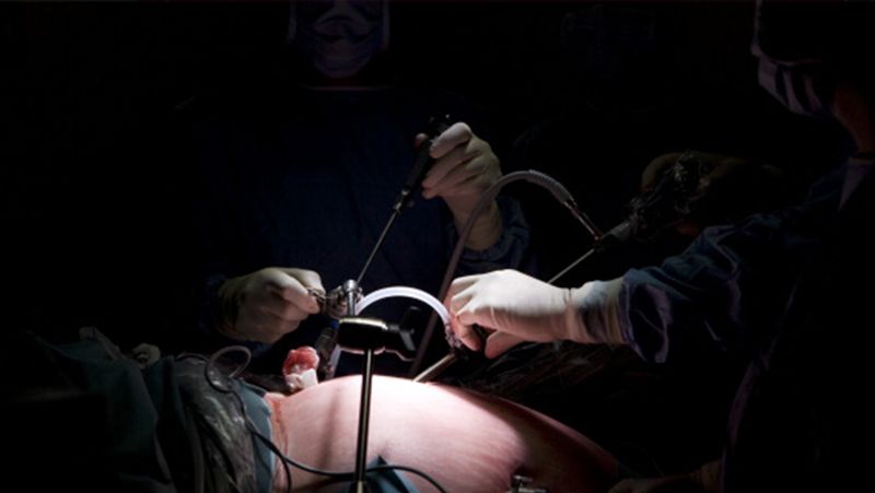 Lithuania man started eating a sharp nail to give up alcohol