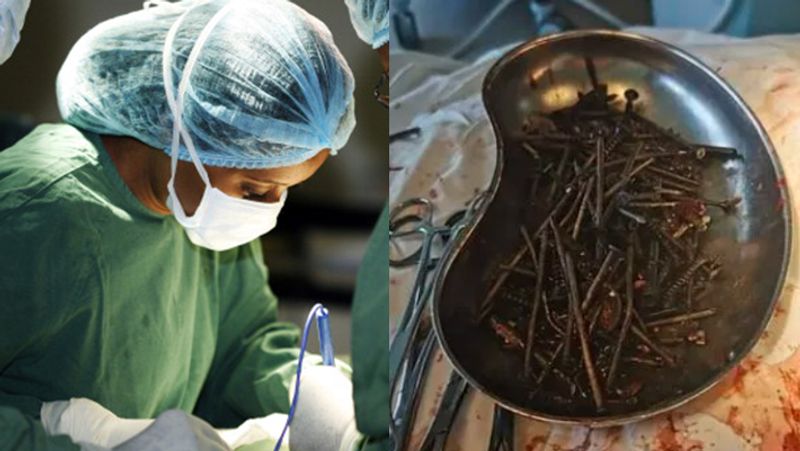 Lithuania man started eating a sharp nail to give up alcohol