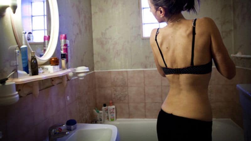 Anorexia girl so weak that her heart beat only 32 times in a minute