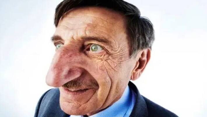 worlds largest nose Turkish man in Guinness World Records worlds largest nose Turkish man in Guinness World Records
