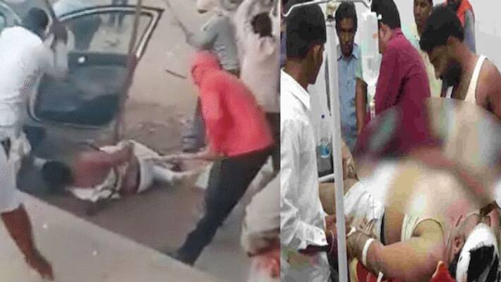 Bikaner Congress leader Megh Singh Bhati beaten up by miscreants on road breaking both his legs and fractures Bikaner Congress leader Megh Singh Bhati beaten up by miscreants on road breaking both his legs and fractures
