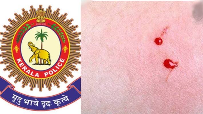 snake bitten girl was taken to hospital Police as rescuers snake bitten girl was taken to hospital Police as rescuers