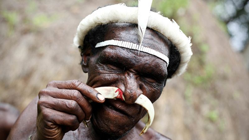 Indonesia Dani Tribes wife fingers are cut off in the death of her husband