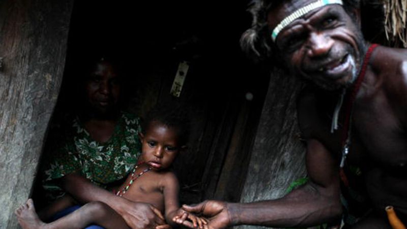 Indonesia Dani Tribes wife fingers are cut off in the death of her husband