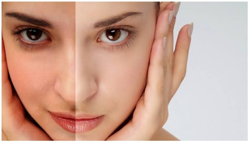 Best home remedies for white skin full details are here