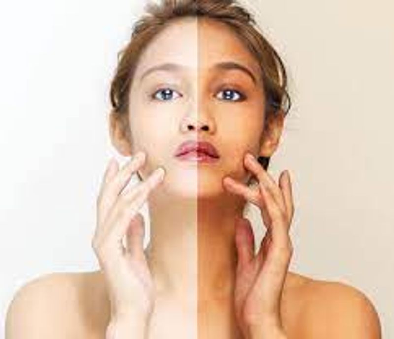Best home remedies for white skin full details are here