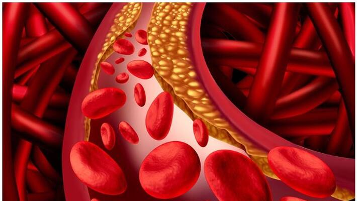 Natural Ways to Lower Your Cholesterol Levels Natural Ways to Lower Your Cholesterol Levels