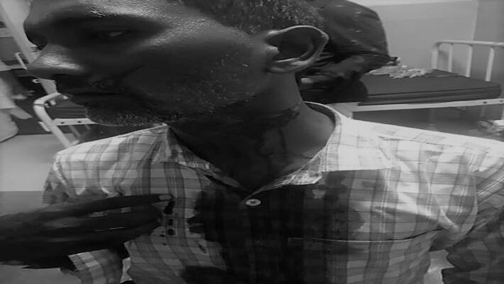 drunken persons held for attempted murder of shopkeeper at sultanabad drunken persons held for attempted murder of shopkeeper at sultanabad