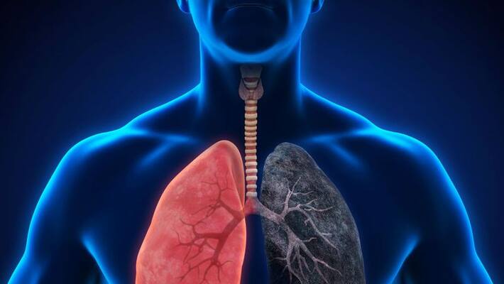world lung cancer day 2022 lifestyle changes to reduce risk of lung cancer world lung cancer day 2022 lifestyle changes to reduce risk of lung cancer