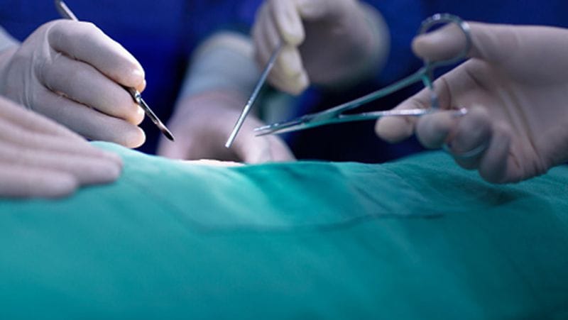 Egypt man kept a mobile in his stomach for 6 months