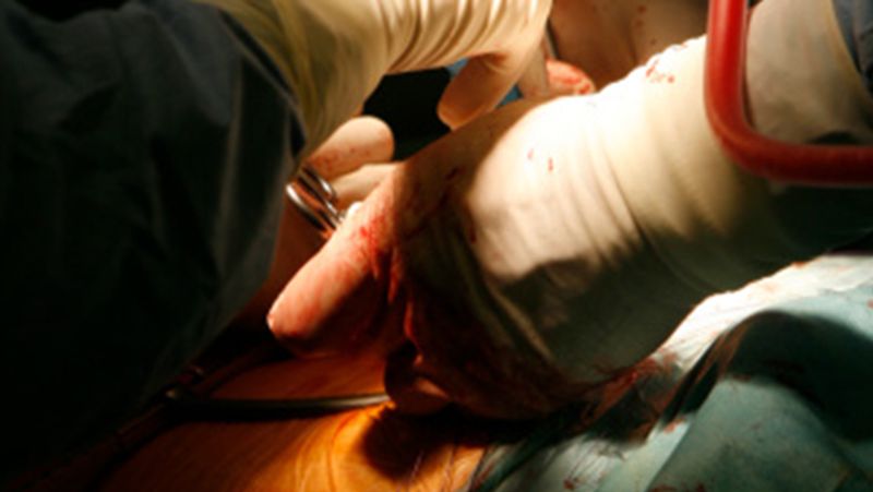 Gujarat doctor had removed kidney instead of the stone now he had pay a compensation of Rs 11 lakh