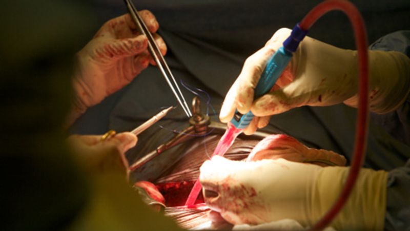 Gujarat doctor had removed kidney instead of the stone now he had pay a compensation of Rs 11 lakh