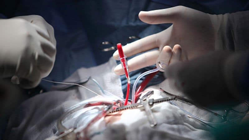 Gujarat doctor had removed kidney instead of the stone now he had pay a compensation of Rs 11 lakh
