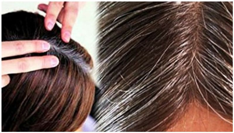 If you Gray hair in young age follow this tips to get healthy hair