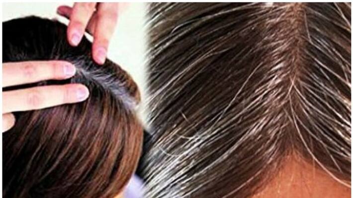 white hair problem know how to reduce this issue bjc white hair problem know how to reduce this issue bjc