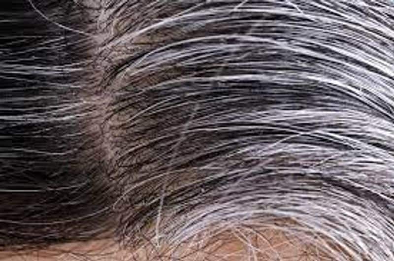 If you Gray hair in young age follow this tips to get healthy hair