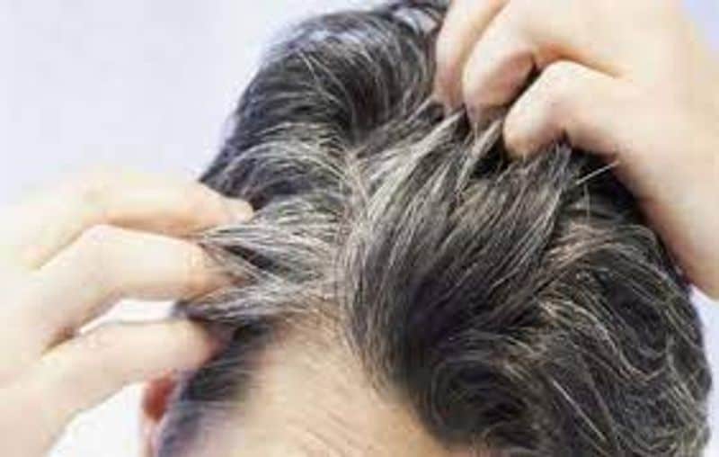 If you Gray hair in young age follow this tips to get healthy hair