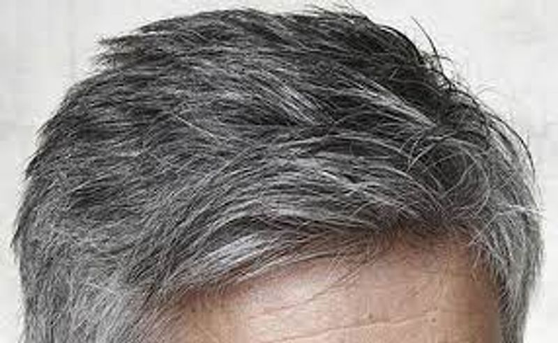 If you Gray hair in young age follow this tips to get healthy hair
