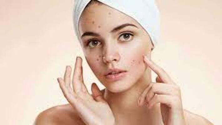 how to remove dark mark patches at home naturally BRD how to remove dark mark patches at home naturally BRD