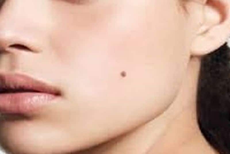 If women has mole on these parts they are very special sexully time
