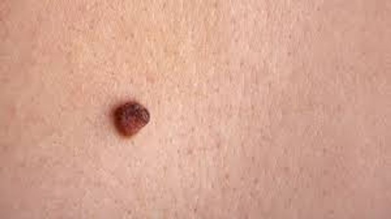 If women has mole on these parts they are very special sexully time
