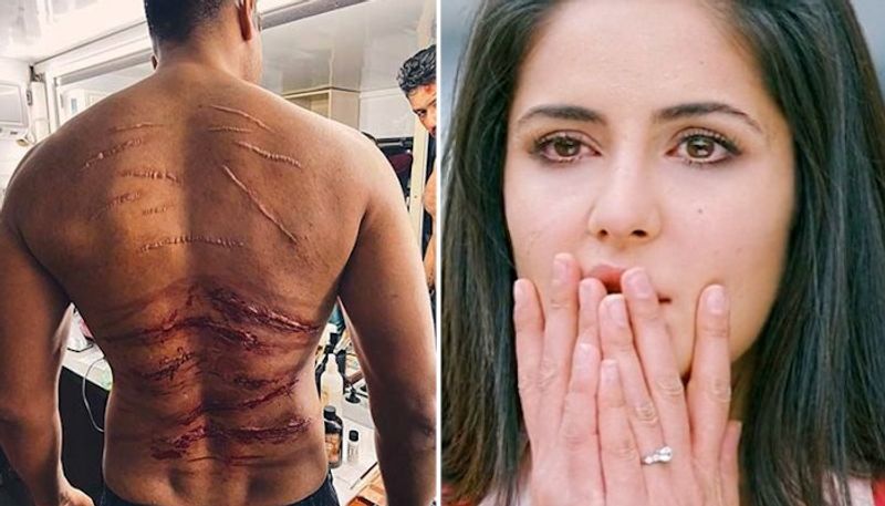 Vicky Kaushal scars go viral netizens say Katrina Kaif ko dukh hoga