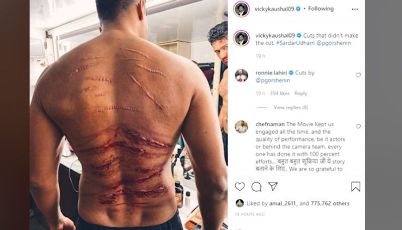 Vicky Kaushal scars go viral netizens say Katrina Kaif ko dukh hoga