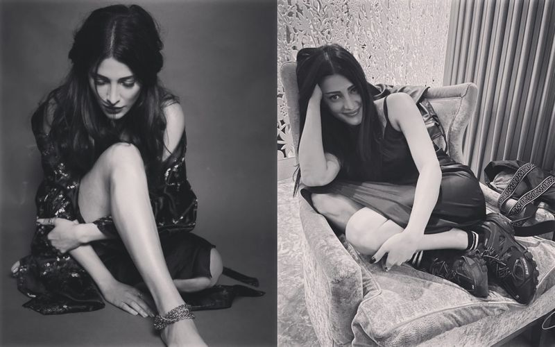 When Shruti hassan openly Admitted to undergoing plastic surgery