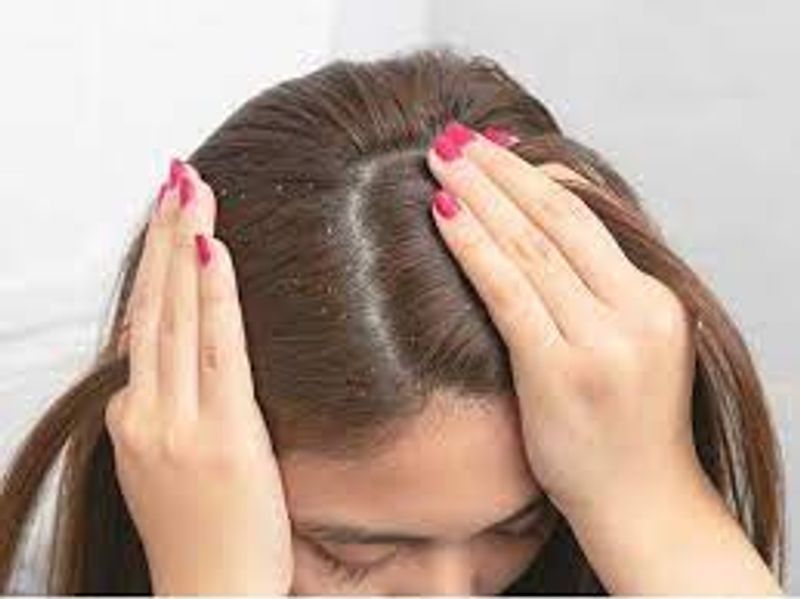 Try this natural hair pack for one time a week to get rid of dandruff full details here
