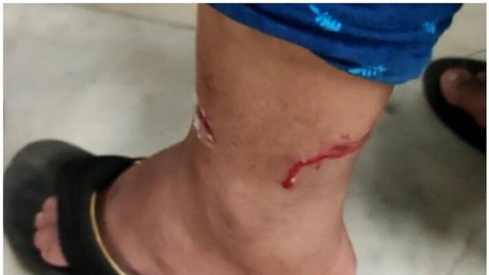 housewife bitten by stray dog while queuing at hospital housewife bitten by stray dog while queuing at hospital