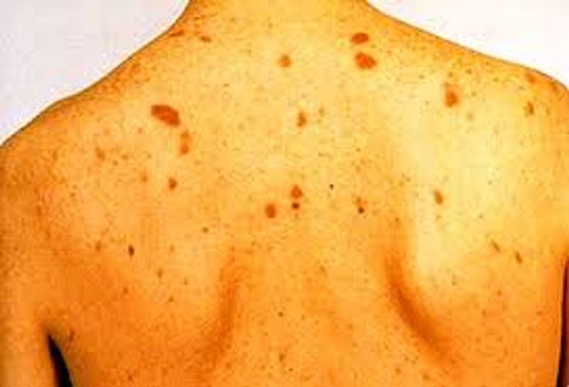Are You drinking too much Alcohol? here is how your skin drops hints