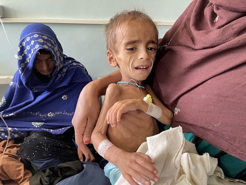 UN warns child mortality in afghan